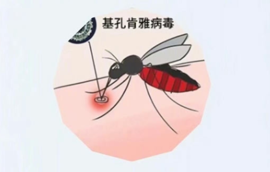 南方多地拉响警报！基孔肯雅热肆虐，这些预防大招你得知道