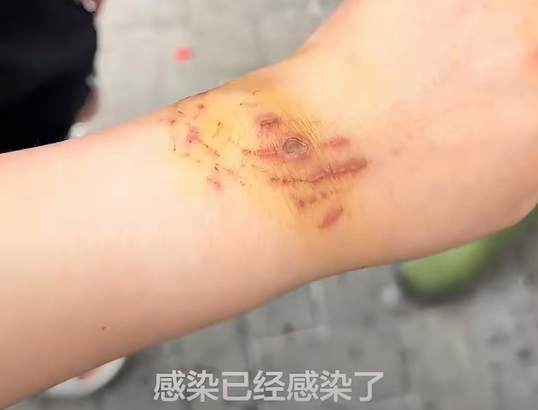 女子为出片拿命赌，生理期挑鲨鱼被咬，截肢警告当玩笑？