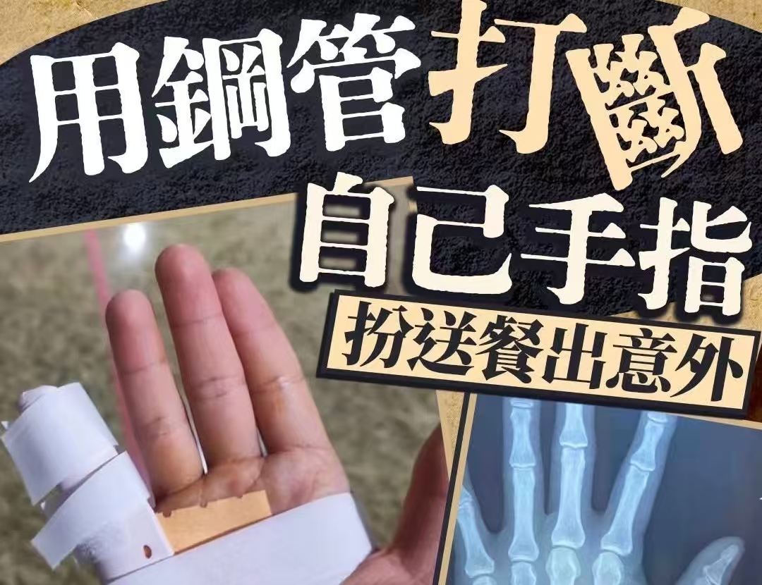 瞒天过海骗保 32 万？外卖骑手自伤造假，风控系统直接戳穿骗局