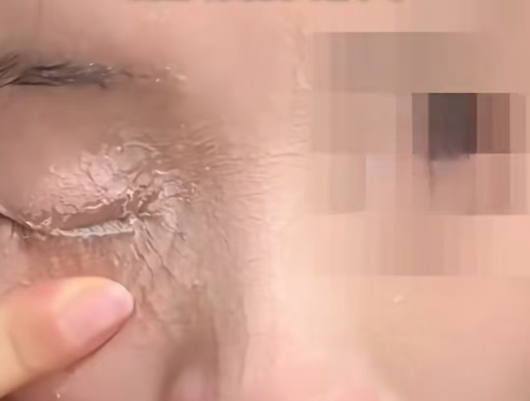 贴甲片误喷502入眼：美丽背后的安全警钟