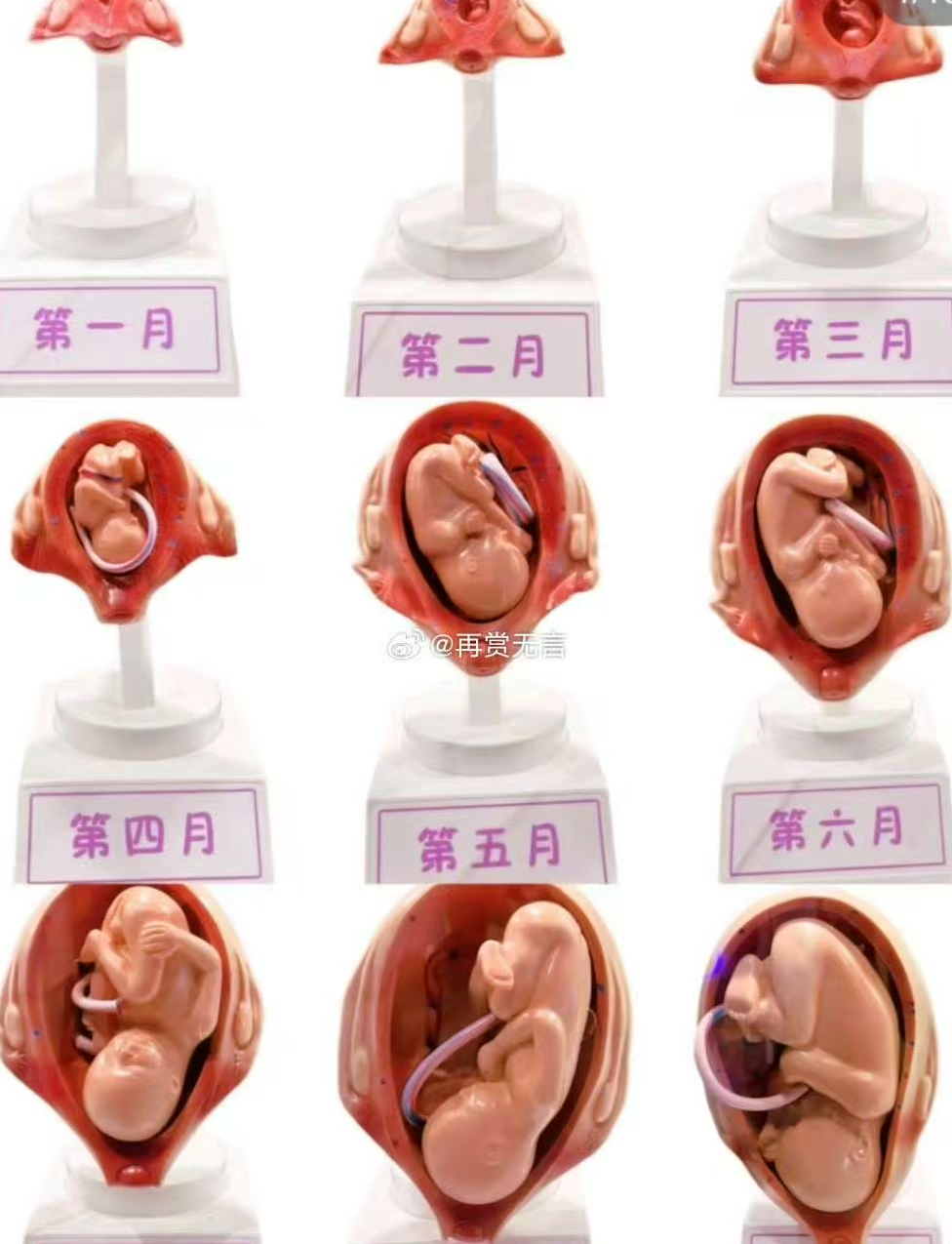 揪心！汕头孕妇孕12周流血就医，才知胚胎已停育6周滞留宫腔