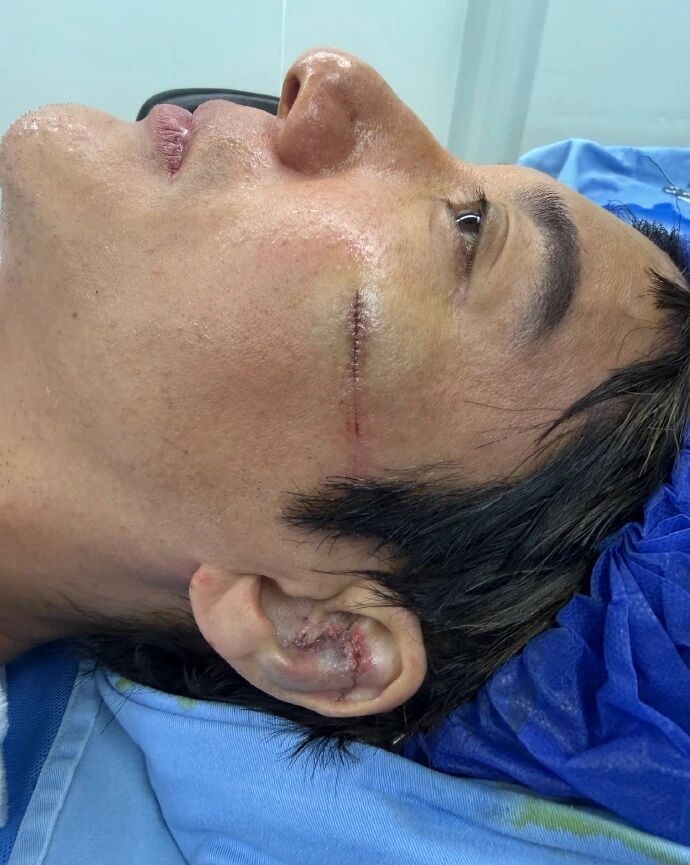 突发！王力宏成都演唱会失足跌倒——台阶滑倒头部受伤，现场一度紧张
