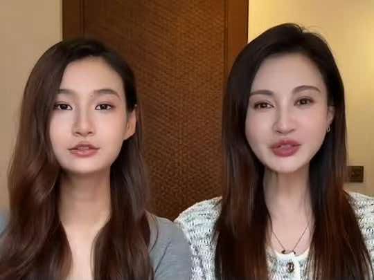 杨雪陪16岁女儿测骨龄，骨骺线近闭合仍超常逆袭5公分