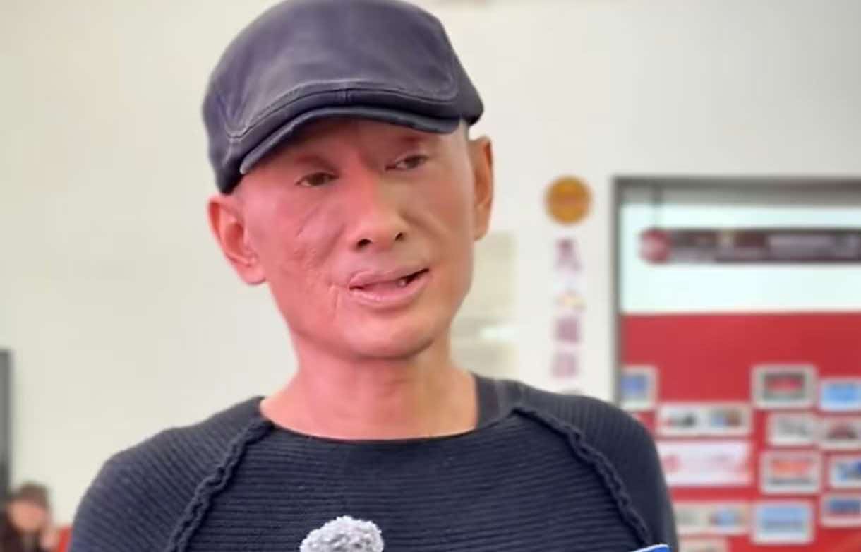 全网深挖！55岁阿宝容貌彻底大变样，嘴角疤痕突兀，三大谜团至今无解